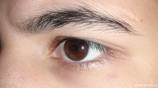 View prev photo