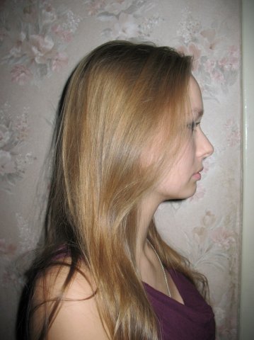 View prev photo