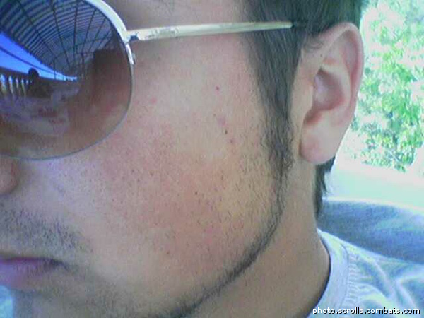 View prev photo
