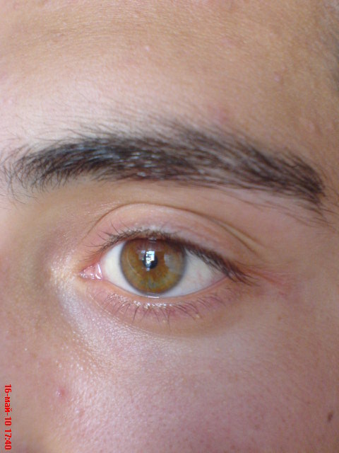 View prev photo