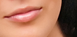 View prev photo